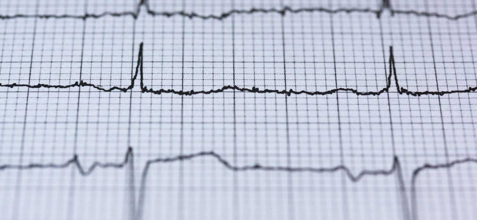 objets-de-santé-connectés-utile-pour-confinemen